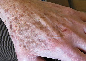 Perteneciente a Dra. Lorea Bagazgoitia